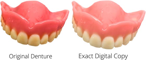 Denture Repairs - Example 1.png