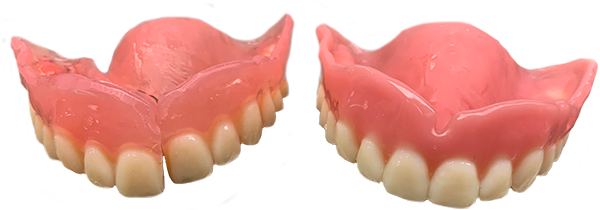 Denture repair example - April 15.png