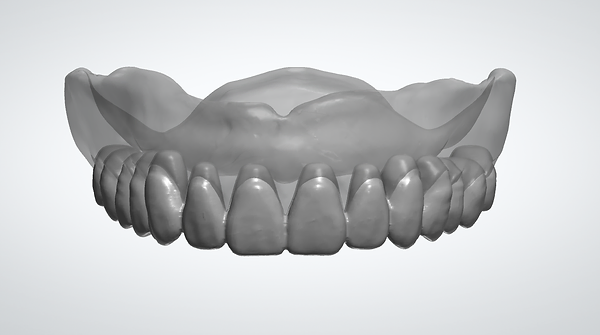 Digital Denture.png