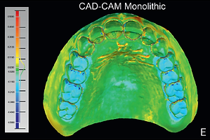 Digital Dentures vs. conventional.png