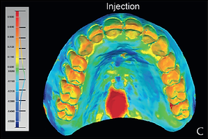 Digital Dentures vs. conventional.png